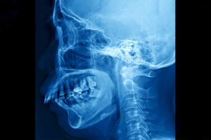 Film x-ray skull and cervical spine lateral view, X-Ray film of human bones from nose to chest.